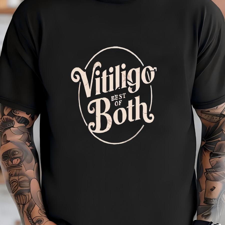 T Shirt Cool Vitiligo Best Of Both Unisex Hoodie Vitiligo Design Soft Tee Durable Tshirt Unique Top T-shirt