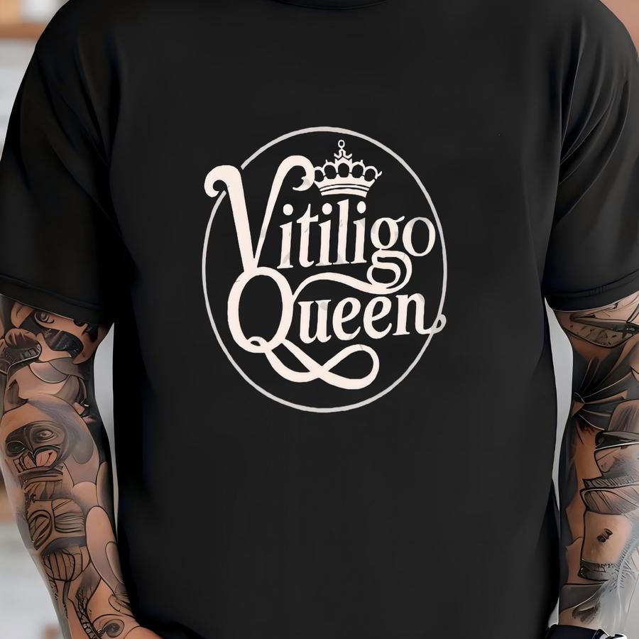 T Shirt Cute Vitiligo Queen Unisex Hoodie Woman With Vitiligo Design Spotted Beauty Queen Awesome Vitiligo T Shirt T-shirt