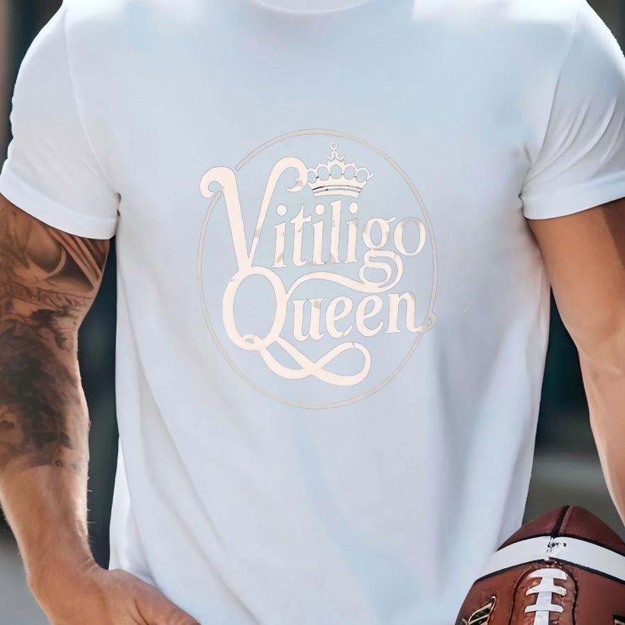 T Shirt Cute Vitiligo Queen Unisex Hoodie Woman With Vitiligo Design Spotted Beauty Queen Awesome Vitiligo T Shirt T-shirt T Shirt Cute Vitiligo Queen Unisex Hoodie Woman With Vitiligo Design Spotted Beauty Queen Awesome Vitiligo T Shirt T-shirt